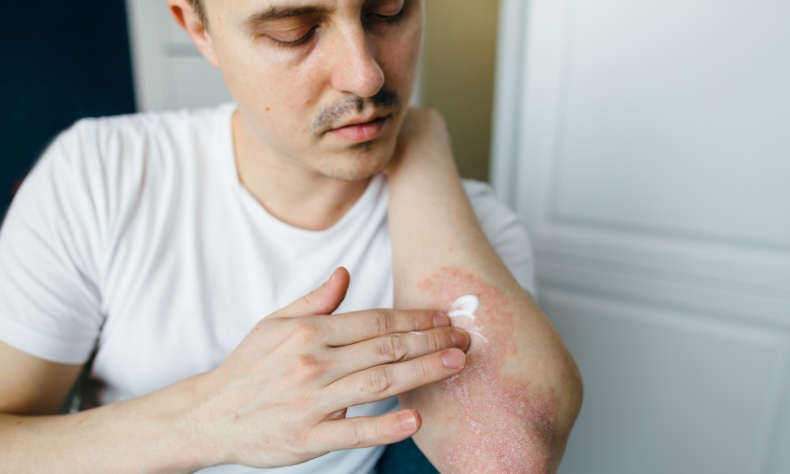 Dr. Cheryl explains Common Skin Conditions